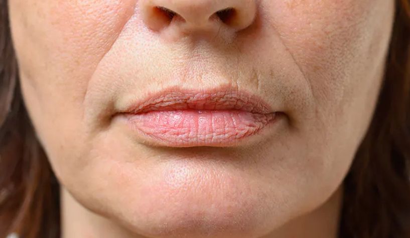 5-τρόποι-για-να-απαλλαγείτε-γρήγορα-από-τις-ρυτίδες-στα-χείλη-–-Το-κόλπο-για-να-μην-φαίνονται